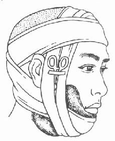 ǯ��Ѫ��ֹѪ��