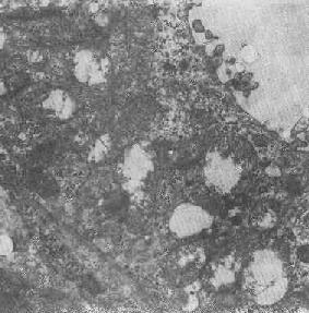 ��С����Ƥϸ�������岿�ֿ��ݱ�