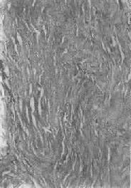 ��ά����֯�Ĳ�������