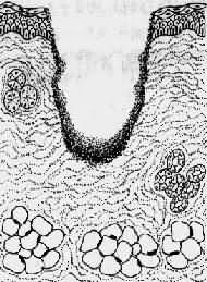 ���ڴ󣬴�Ե��������֯�ƻ���