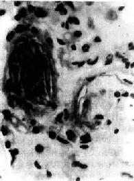 ����ˮ˨��