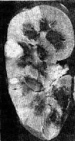 ��ƶѪ�Թ���