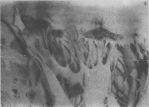 ������Ǵ����İ�Ĥ<a href=