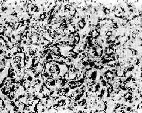 ëϸѪ��<a href=