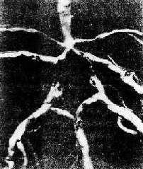 �Ե׶���Willis�������֧����Ӳ��