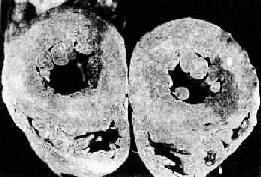 ��Ѫѹ��ʱ�����������Էʴ��������棩