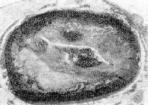 ��״���������߿鲢��Ѫ˨�γ�