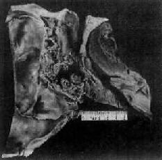 ����<a href=