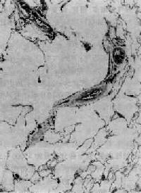 ���������ͷ�����