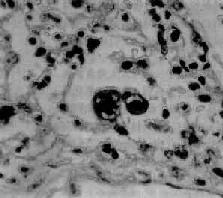 �ٲ�������