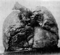 �������β������Ĳ�