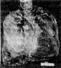 ���Է�Դ�����ಡ