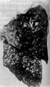 �����ͷ�<a href=