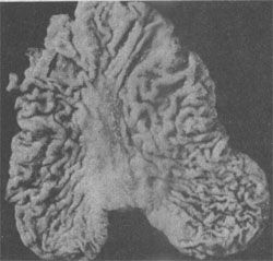 ����θ<a href=