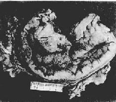 ����������θ<a href=