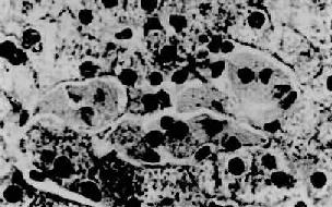 ��ѩ��֮��