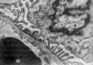 ������С���˹�Ĥ