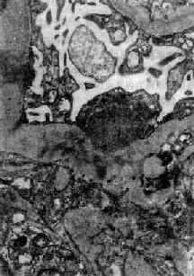 ëϸѪ������������С������