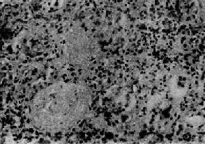 ������Ӳ������С������