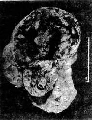 ��ϸ��<a href=