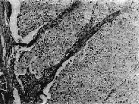 ��͸��ϸ��<a href=