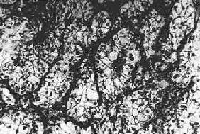 ��͸��ϸ����<a href=