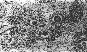 ��ĸϸ��<a href=