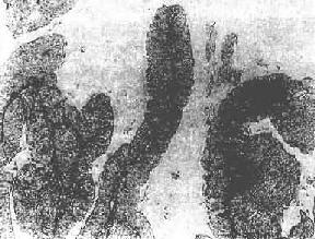 ��������ϸ����ͷ״<a href=