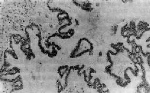 �ѳ���ͷ״��Һ������<a href=