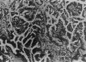 �ѳ���ͷ״��Һ������<a href=