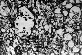 �����<a href=