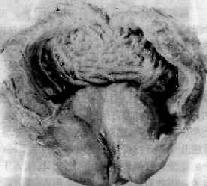 ǰ��������֢