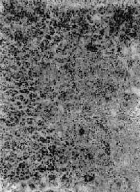 Sheenan�ۺ���֮����