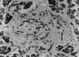 ����֮�ȵ�ͼʾ�ȵ���������