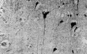 ��ϸ��ȱѪ�Ա仯