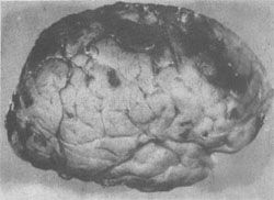 ����ȱѪ���Բ�