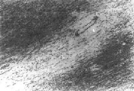 Ѫ����Χ�����ʣ�����Ⱦɫ��