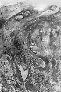 ������<a href=