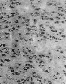 ������<a href=