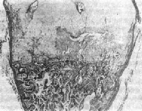 ���Ͳ��Ĺ����ǽ��紦���߹ǣ�