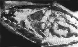 ����Ը�Ĥ��