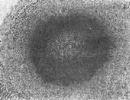 ��Ѫ���没֮���Գ��ѽ��