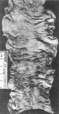 ����Ѫ���没�Ľ᳦