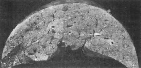 �μ���Ѫ���没