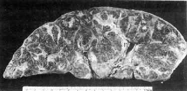 Ѫ���没�Ը�Ӳ��