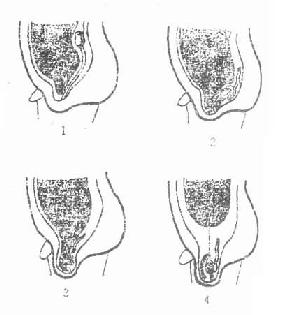 غ���½�����