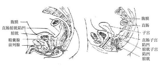 ��Ů����ʸ״���棨ʾ��Ĥ��������ϵ��