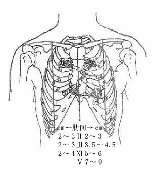 �ĵ����ͶӰ���Ľ�ߵ��