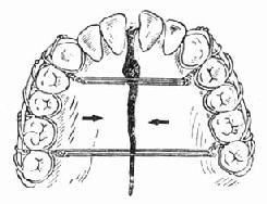 �������ι��ۿ������ǣ����λ�̶���