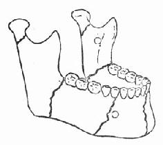 �����׷������۵ı�������